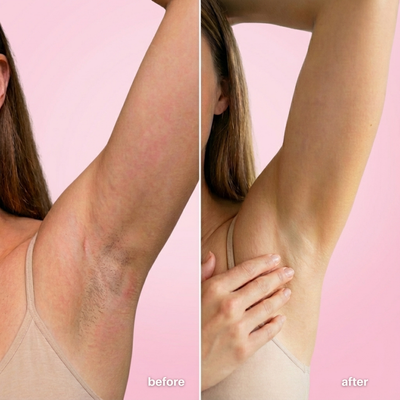 No-Shave Hair Removal Cream